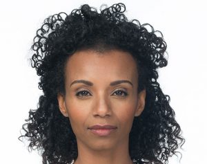 Botox before and after