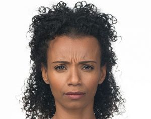 Botox before and after