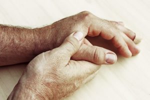 Psoriasis