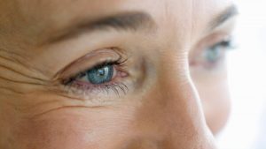 Wrinkle treatment